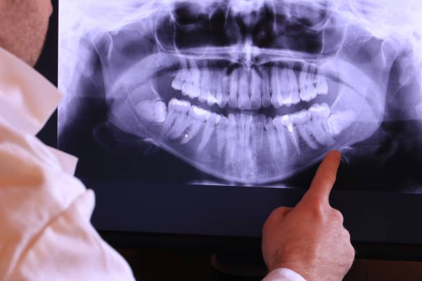 Best Broken Tooth Emergency  in Du Quoin, IL