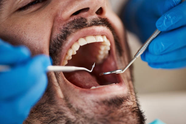 Best Root Canal Emergency Dentist  in Du Quoin, IL